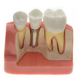 Dents en plastique de haute qualité modèle anatomique, dentaire - Chine  Modèle dentaire, dents en plastique anatomique